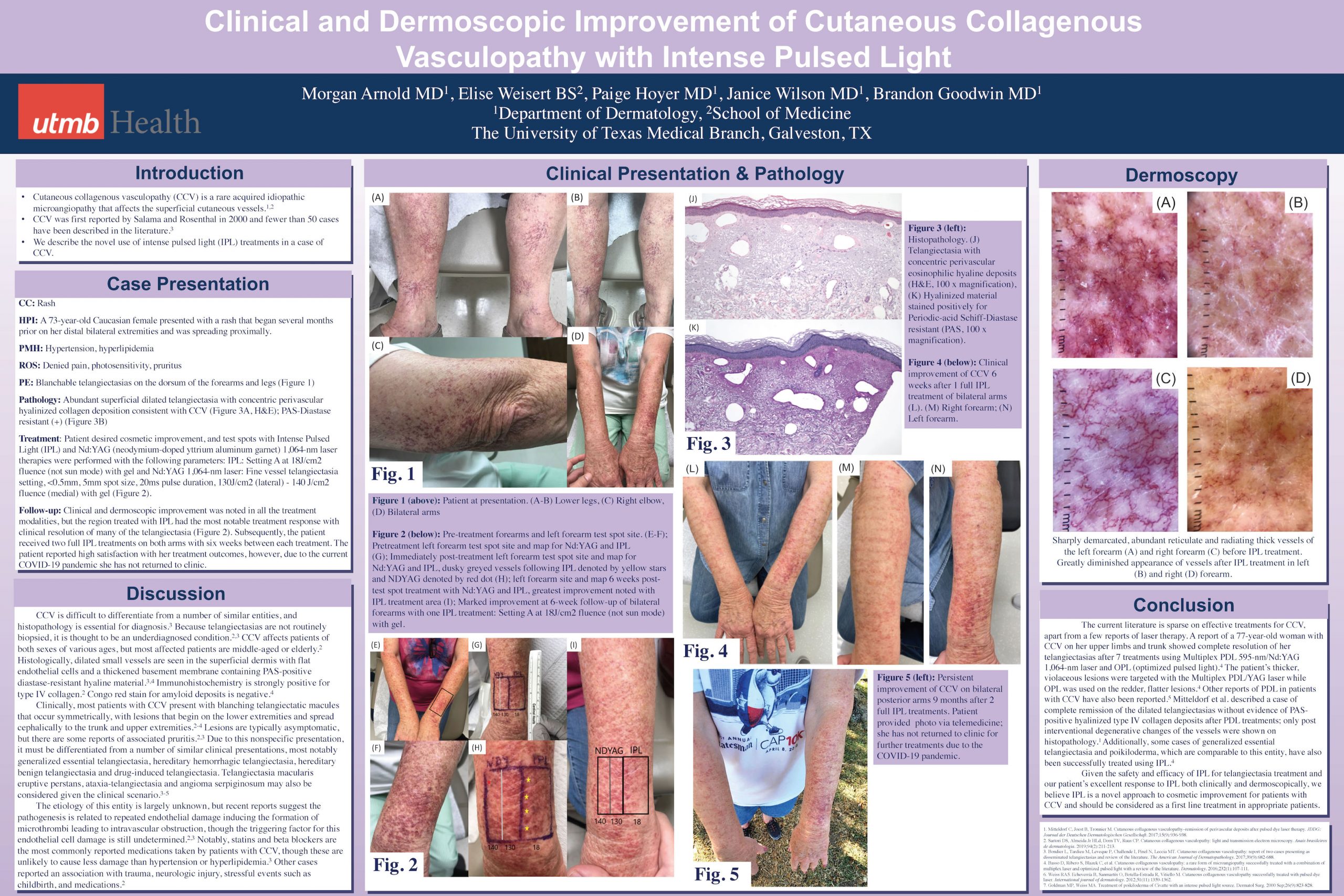 Clinical and Dermoscopic Improvements Poster