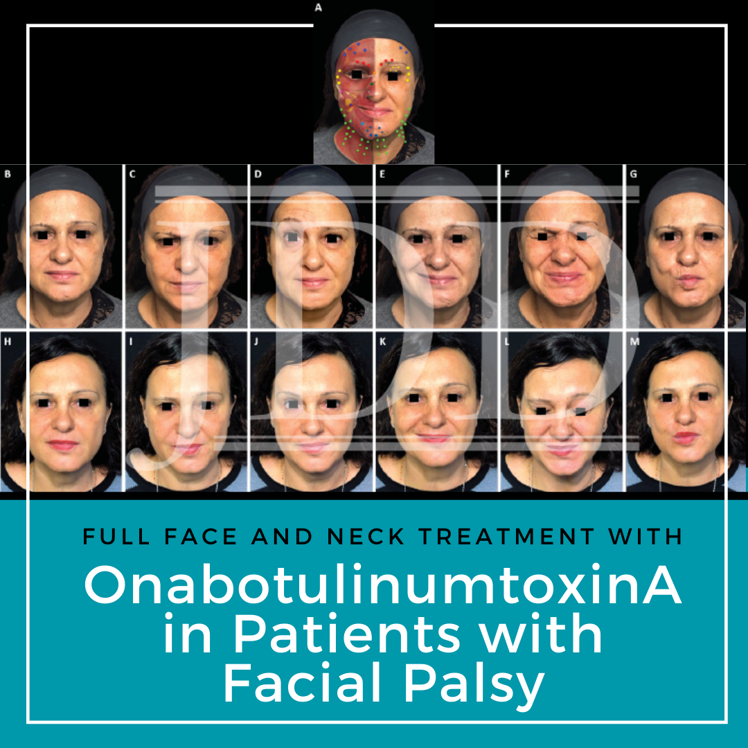 Key Pearls for Managing a Facial Nerve Palsy Patient - American