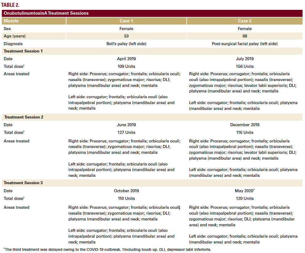 OnabotulinumtoxinA Treatment Sessions