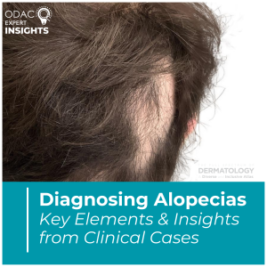 diagnosing alopecia