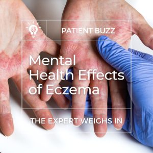 eczema and mental health