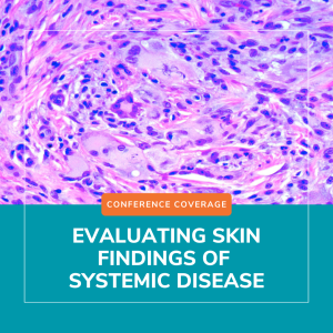 skin findings of systemic disease