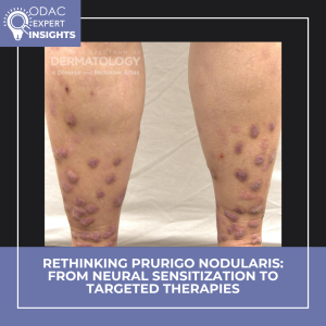 prurigo nodularis