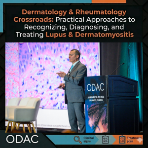 autoimmune connective tissue disorders